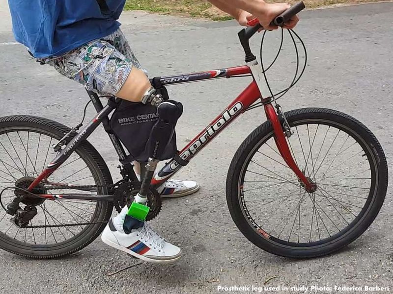 Scientist Are developing A New Prosthesis That Restores Natural Feeling in Lower Leg Amputees